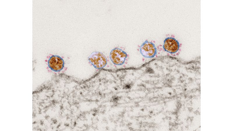 Mikroskopische Aufnahme von Corona-Viren an einer Zelle 