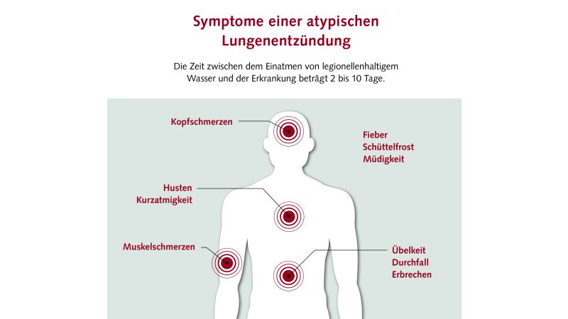 Die Grafik zeigt Symptome der atypischen Lungenentzündung Legionellose.