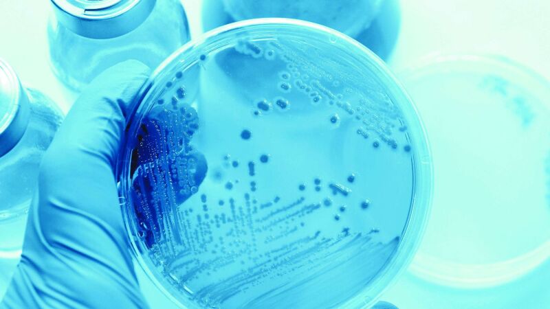 Bild zeigt Bakterienkultur: Nicht nur die Menge, auch die Art der Legionelle bestimmt das Risiko! Führt das zu Konsequenzen für die Trinkwasserhygiene 